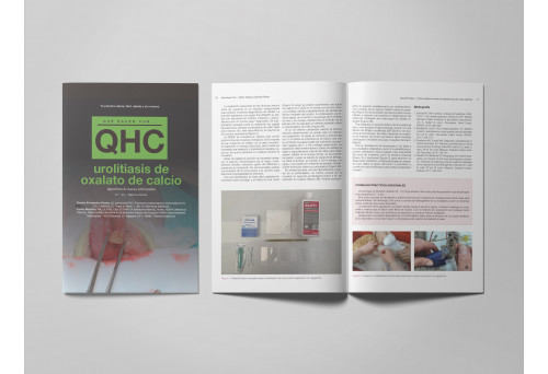 Revista QHC Urolitiasis de oxalato de calcio -Que Hacer Con... veterinaria
